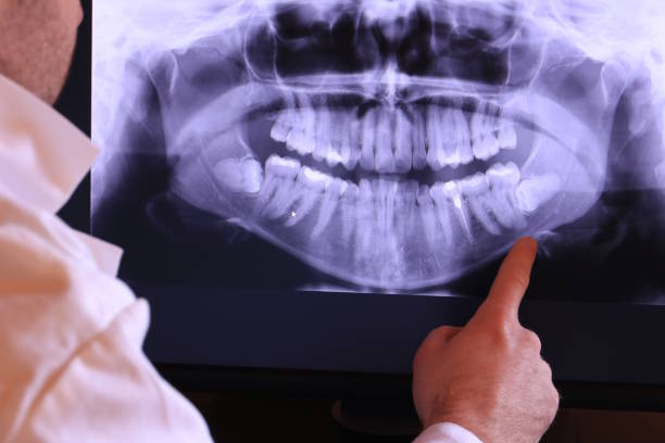 Best Weekend Emergency Dentist in Carrizo Springs, TX